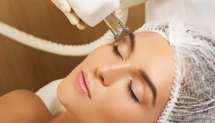 การยกด้วยความร้อน