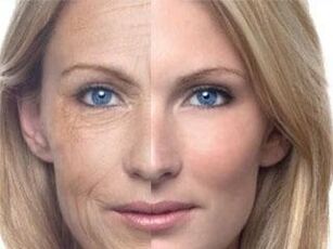 ผิวคล้ำ